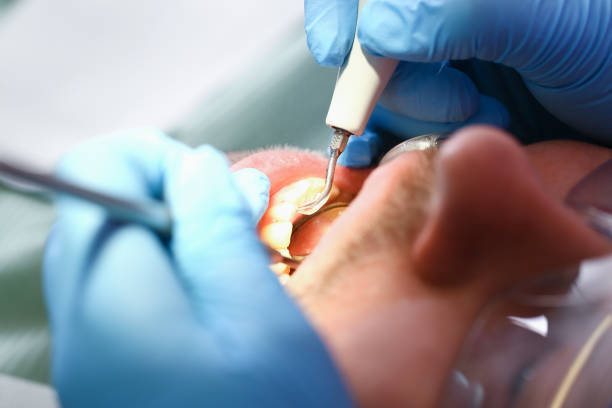 Best Same-Day Emergency Dental Services in Ransom Canyon, TX