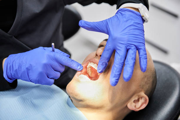 Best Emergency Treatment for Dental Infections or Abscesses in Ransom Canyon, TX