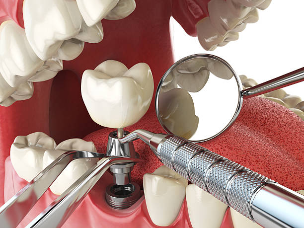 Best Same-Day Emergency Dental Services in Ransom Canyon, TX